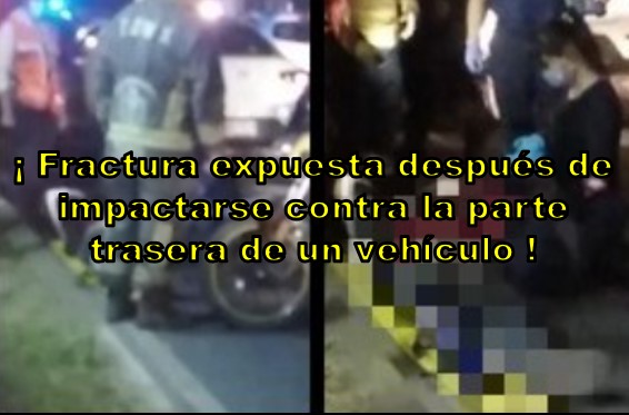 Motociclista se impacta por alcance con un vehículo en la alcaldía Miguel Hidalgo
